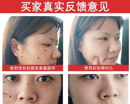 玫瑰花长黑点可能是哪些原因造成的？